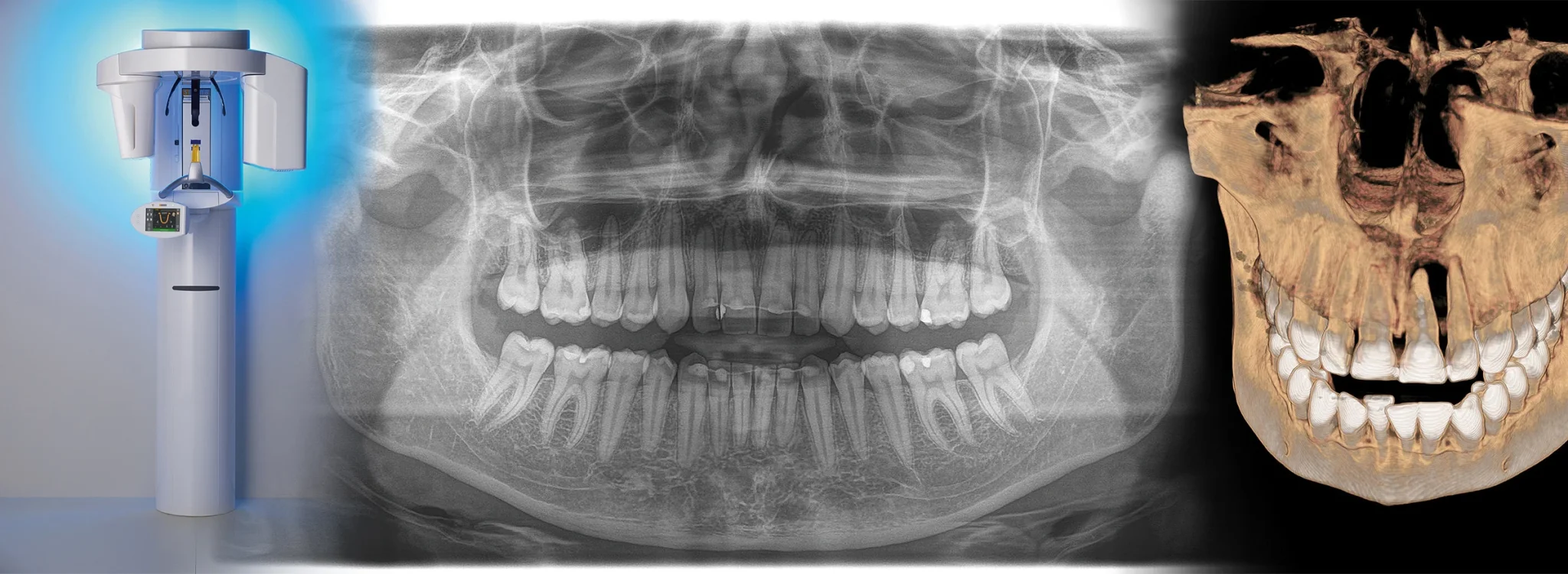 DVT-Gerät mit OPG Aufnahme und 3D-Rekonstruktion sowie 2D Röntgenbild